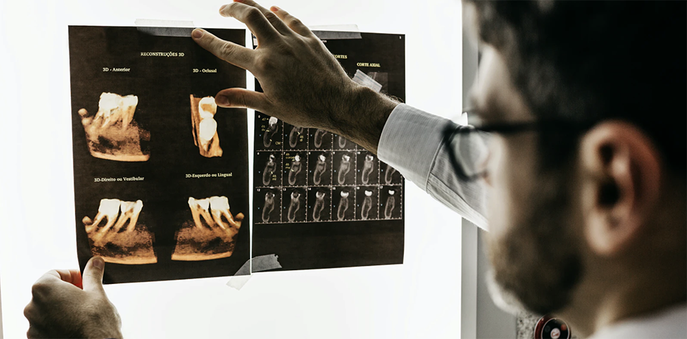 x-ray